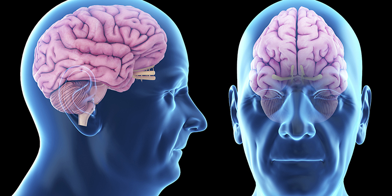 Nguyên nhân dẫn đến bệnh Alzheimer