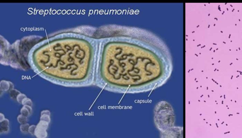 Streptococcus pneumoniae