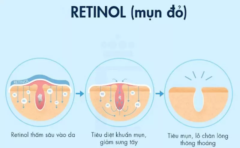 Retinol