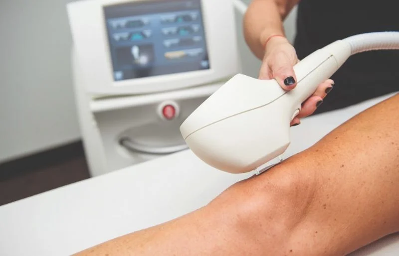 Hiệu quả sau sử dụng công nghệ triệt lông IPL